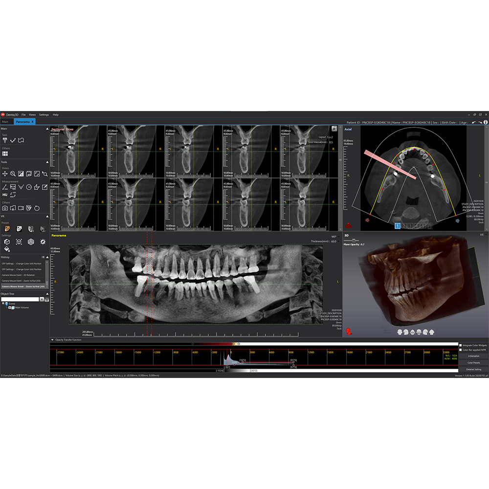 [3D Industrial] Dentiq3D