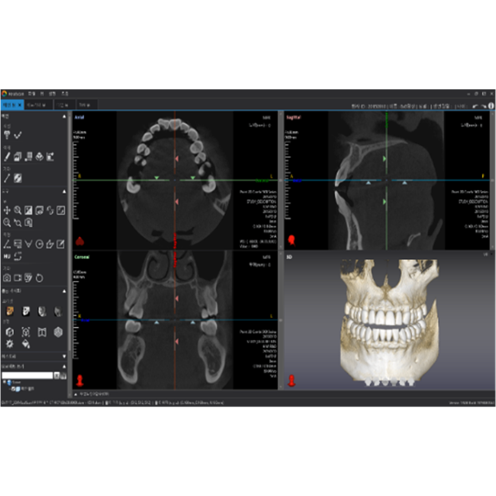[3D Industrial] Dentiq3D