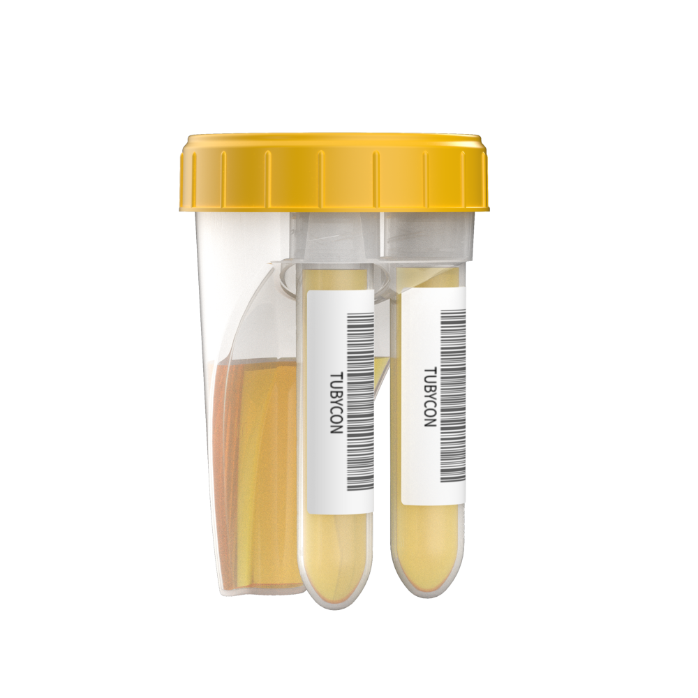 TUBYCON Dual Tube Urine Test Cup Kit